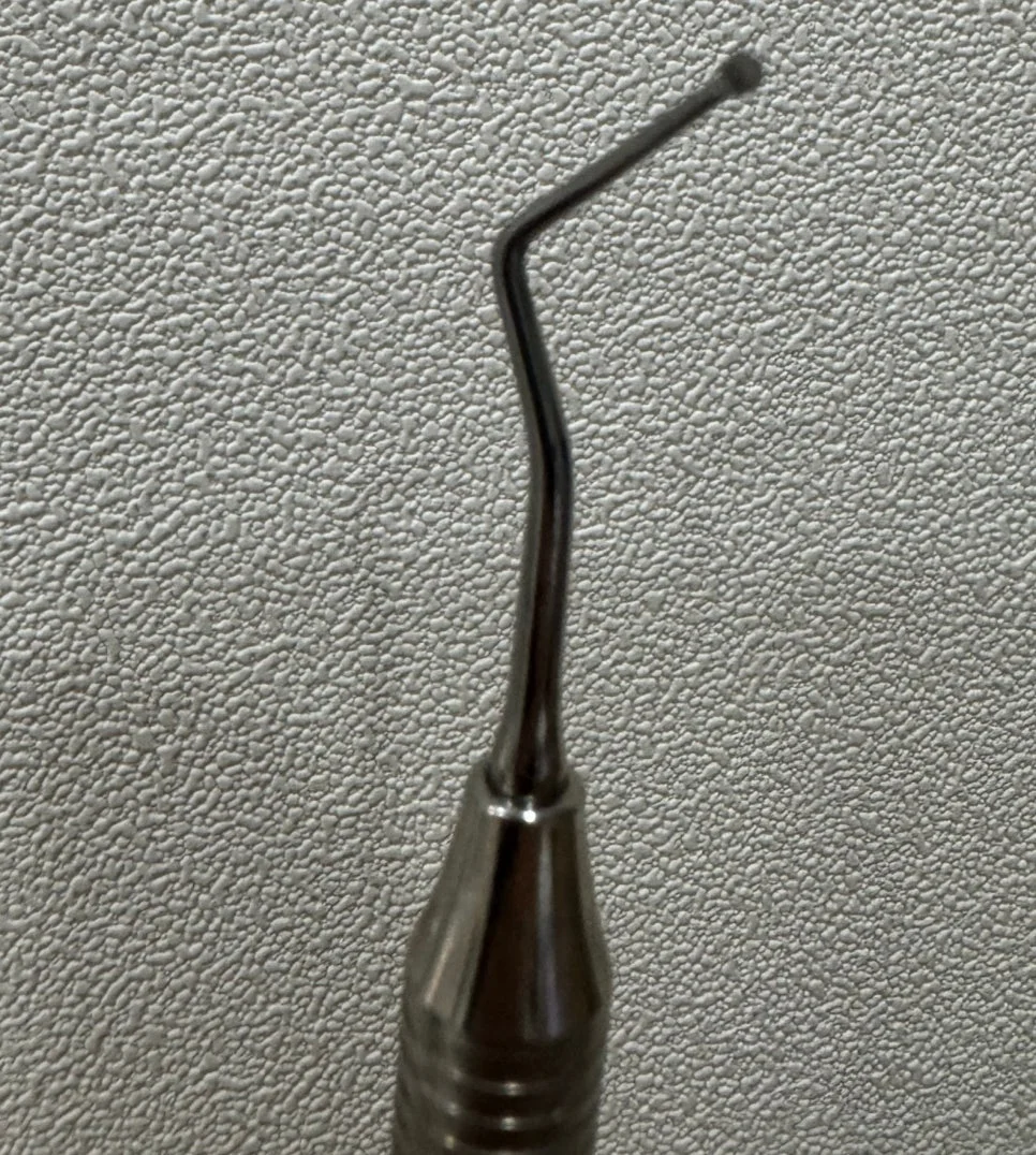 충치 제거 후 소독된 치아 표면