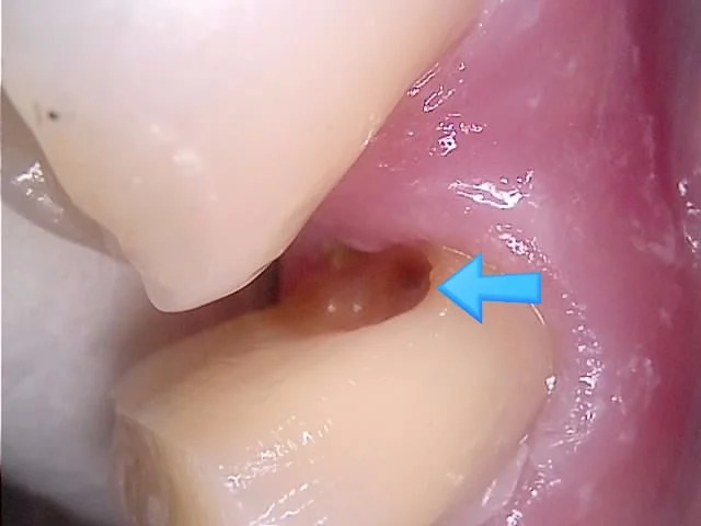 경계 정비 과정 근접 사진