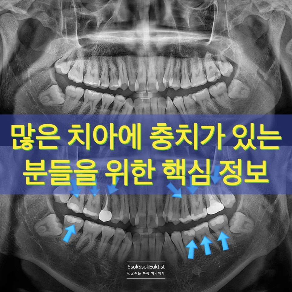 종합 치료 파노라마 방사선 진단