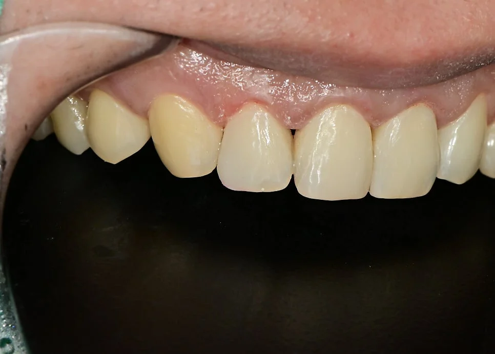 수정 후 개선된 결과