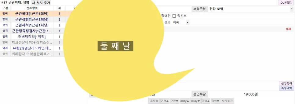 신경치료 2회차 본인부담금 19,000원