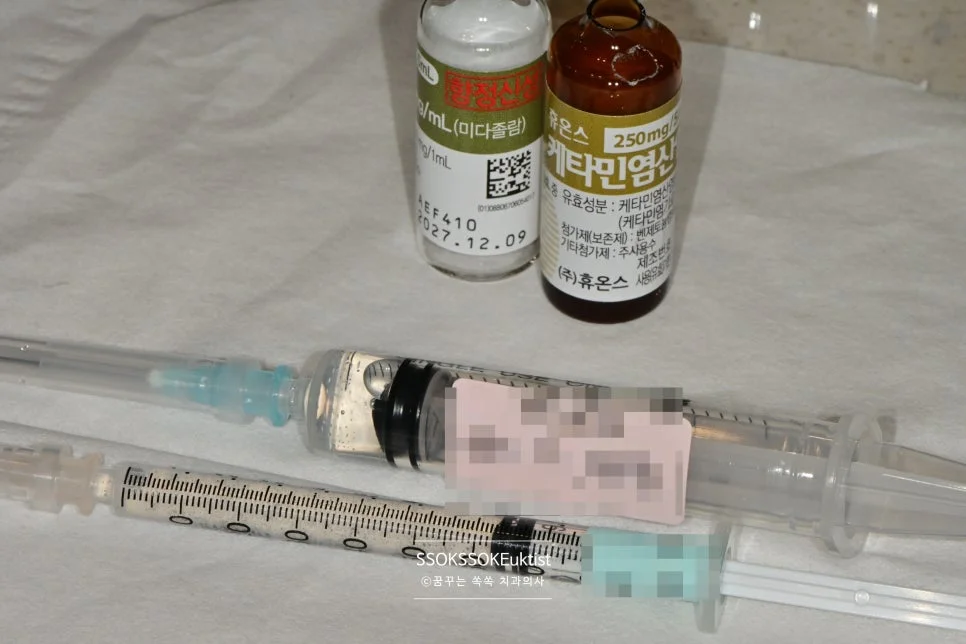 수면 진정 약물 미다졸람 케타민 바이알