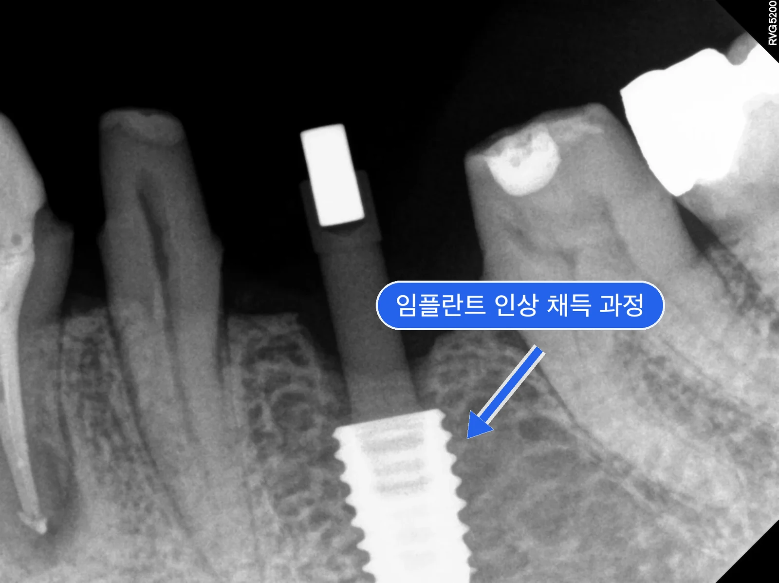 차오순_20250922_111532