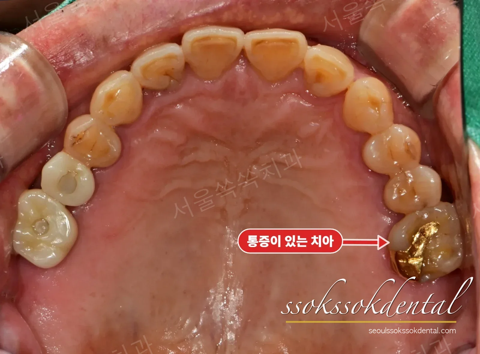 김현옥_20250717_175407
