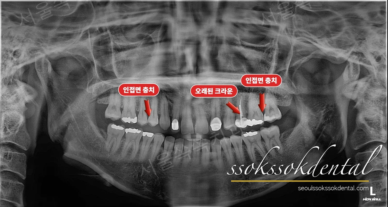 초진 파노라마