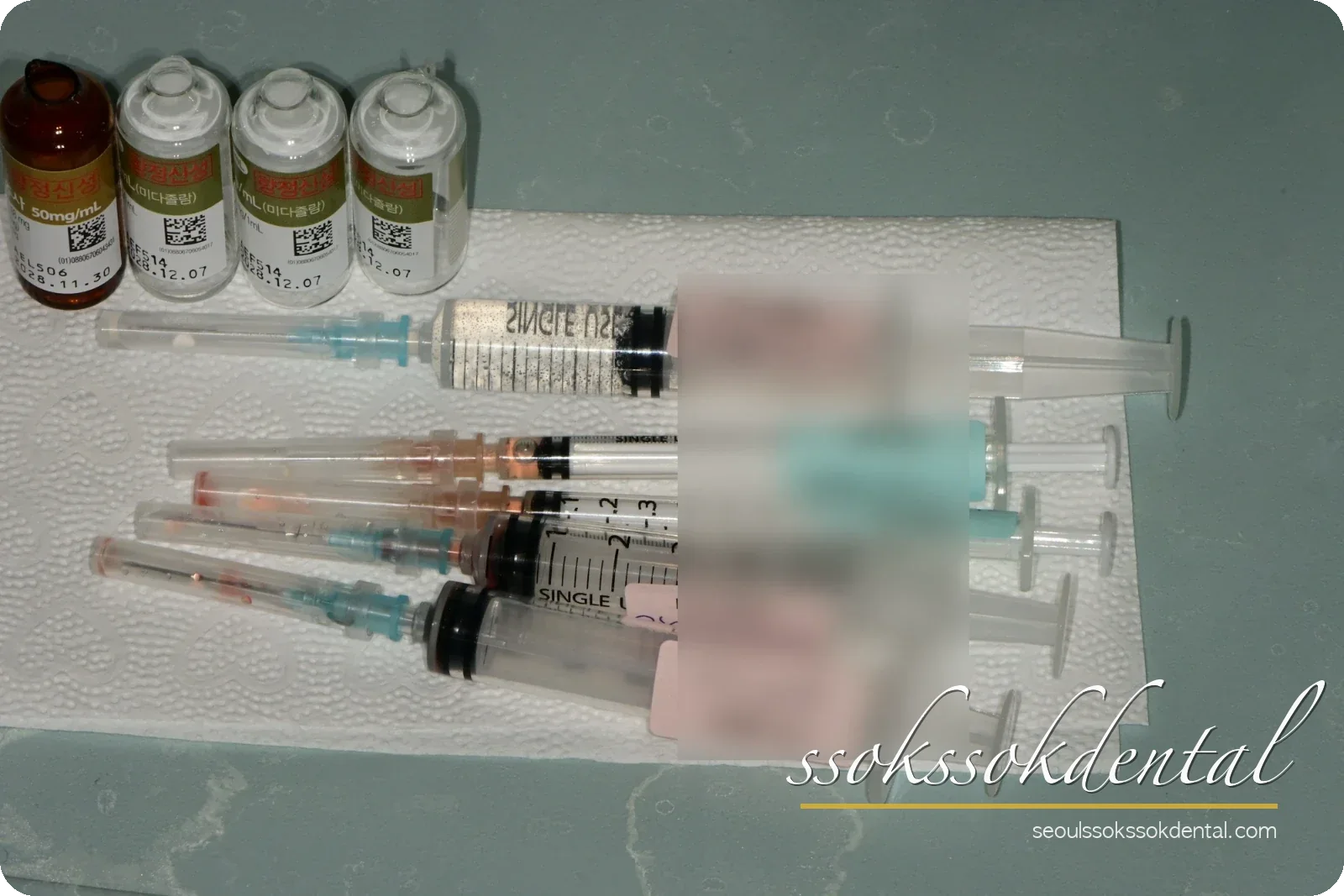 재신경치료 당일 진정 진행 기록