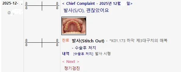 S/O 차트