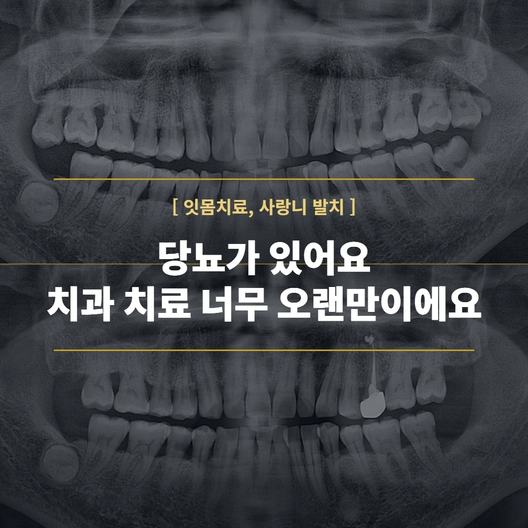 당뇨가 있어요. 치과 치료는 너무 오랜만이에요 — (강서구 마곡 치과)